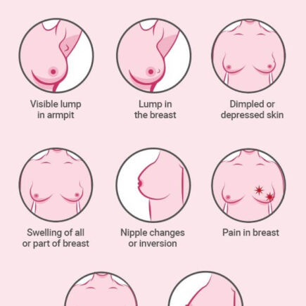 breast cancer infograph