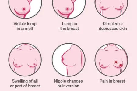 breast cancer infograph