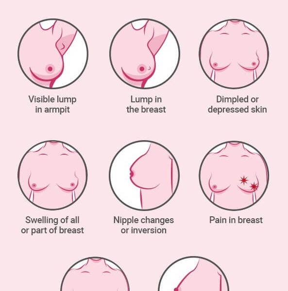 breast cancer infograph